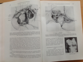 Pakket a 6 delen Chirurgische Operationslehre - Bier / Braun / Kümmell