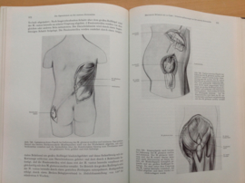 Pakket a 6 delen Chirurgische Operationslehre - Bier / Braun / Kümmell