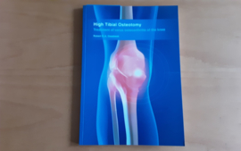 High Tibial Osteotomy - R.D.A. Gaasbeek