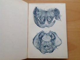 Set a 2x Mikroskopisch-topographischer Atlas des menslichen Zentralnervensystems - O. Marburg