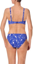 Amoena Prothese Bikini B Cup