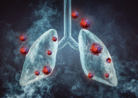 Complete Lung Scan - 30 min consult