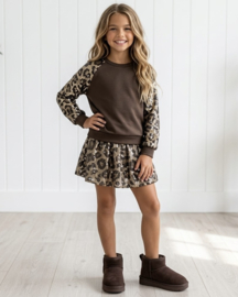 Wild Glam Leopard Set