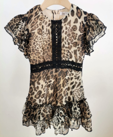 Your leopard dress