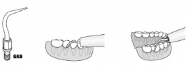 WP TANDSTEEN TIP GK6