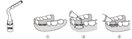 WP CHIRURGIE TIP TITAN US6