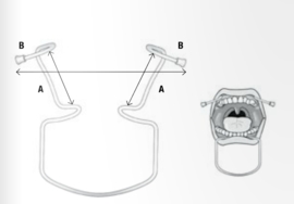 MEDESY RETRACTOR ORINGER