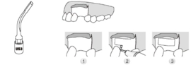 WP CHIRURGIE TIP TITAN US3