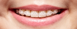 SAPPHIRE  BRACKETS, ROTH 0.18/0.22, SET