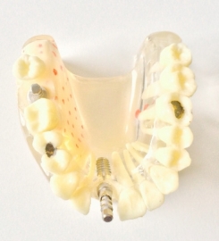 DEMO MODEL DIVERSEN