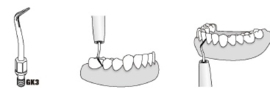WP TANDSTEEN TIP GK3