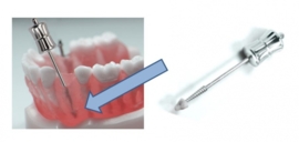 MEDESY ROOT EXTRACTOR LONG