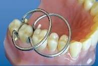 EASYDENTAL RING SET