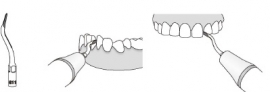 WP TANDSTEEN TIP DIAMOND GK11