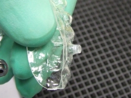 CLEAR ALIGNER BUTTON TANG