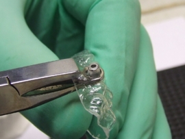 CLEAR ALIGNER BUTTON TANG
