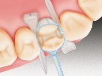 DISPENS-O-MAT MOLAR