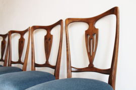 Set sierlijke antieke stoelen. 4 vintage Queen Ann stoeltjes, blauw