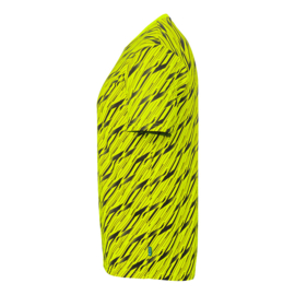 Uhlsport Progressive Goalkeeper Bundle Fluo Yellow / Black