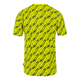 Uhlsport Progressive Goalkeeper Bundle Fluo Yellow / Black