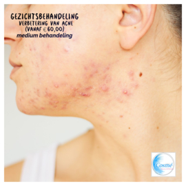 Gezichtsbehandeling Acné  - Sebum (vanaf € 50,00)