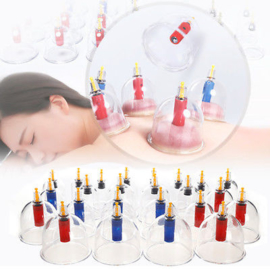 Cupping set met pomp 12 stuks - Ba Guan