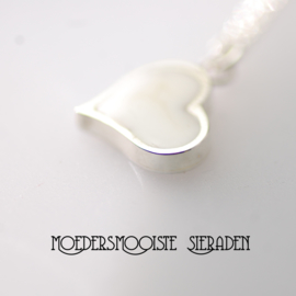 Moedermelk Collier Acceptance