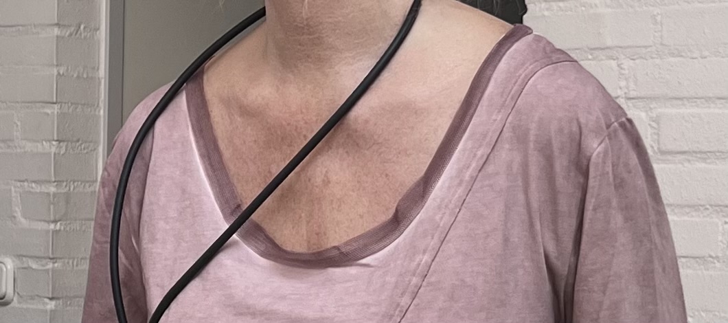 LUUKAA de modieuze kleuring oversized katoen  A-lijn jurk/jurk met tule/ stretch