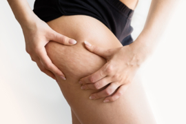 opleiding | MESO ANTI-CELLULITE