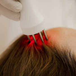 training | ELECTROPORATIE HAIR & SCALP (haargroei)