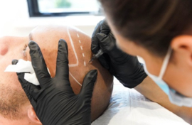 HAIRDOCTORS opleiding 4 dagen | MHP MICRO HAAR PIGMENTATIE & PIGMENTATIE HAARVOLUME incl. startpakket en machine