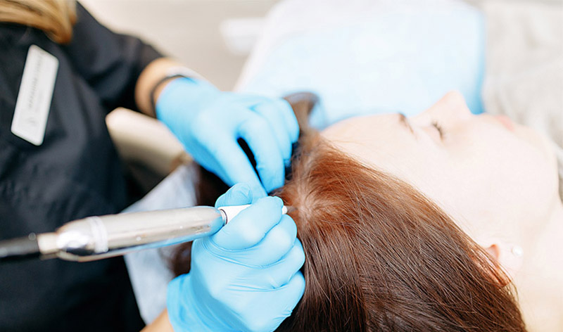 HAIRDOCTORS opleiding | PMU MICRO HAIRGROW THERAPY