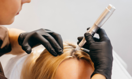 HAIRDOCTORS opleiding | MICRONEEDLING HAIRGROW