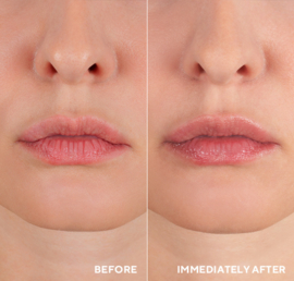HydroPeptide PolyPeptide Collagel+ Lip Mask ~ Masque hydrogel liftant pour les lèvres