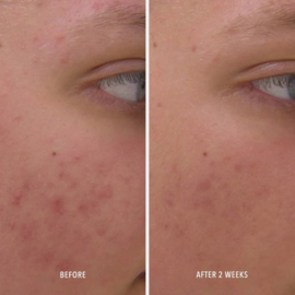 HydroPeptide Clear Rescue Serum