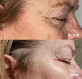 HydroPeptide Vital Eyes