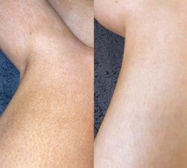 He-Shi Tint remover - Tan remover & primer