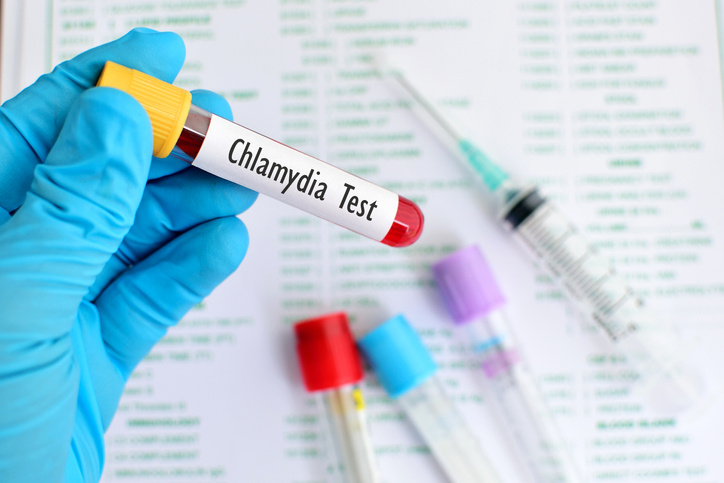 Alles over Chlamydia (Soa)