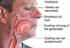 Huisstofmijt-allergie symptomen