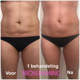 VOOR EN NA FOTO'S BIOSLIMMING 1