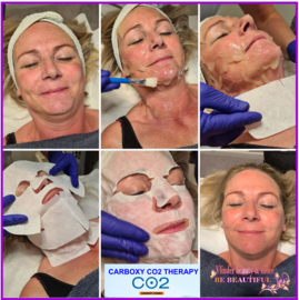 Carboxy CO2 therapy € 69,95