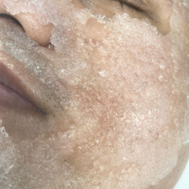 CRYOFACIAL Bij te boeken bij een gezichtsbehandeling!!