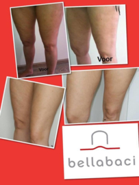 Kus je cellulite vaarwel! Benen, Billen Cupping  € 45,00