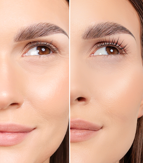 Nanolash LASH LIFT KIT