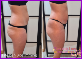 VOOR EN NA FOTO'S BIOSLIMMING 1