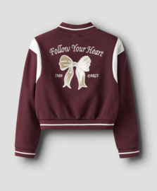 Name It - Vest - NMFRIVEA - Backprint - Strik - Burgundy