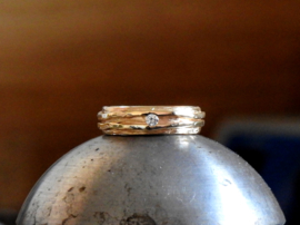 Dents of life ring