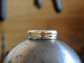 Dents of life ring