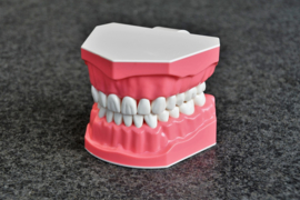 Dental model for OMFT instruction