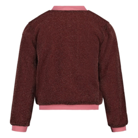 Jubel bomberjack roze glitter - Chic City